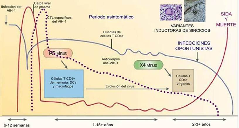 30 años de SIDA